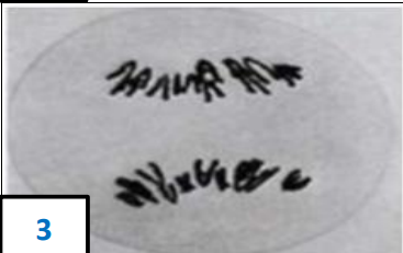 <p>ANAPHASE I</p>