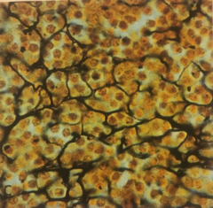 <p>-location : liver, kidney, spleen, bone marrow</p><p>-function : support</p>