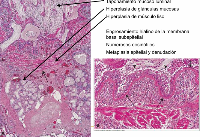 <img src="https://remnote-user-data.s3.amazonaws.com/Zj0d8N26McJc298jPBOsPforfN26UiKCbL6wTMvv1nBVZXcCPVfMZ7tW_NHwlDRgfil5zQ1IfeV6i0tf8EvigRyuZcLgJeAlU8Lv3V7FenyueUzBFG4EKJyCrsxHXTnl.png" data-width="100%" data-align="center"><p></p>