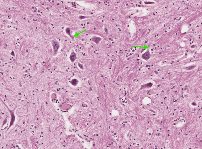 term image