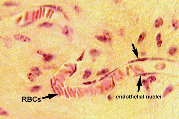 <p><strong>simple squamous epithelium</strong></p><p></p>