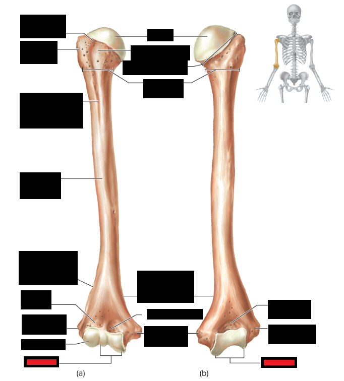 <p>Which part of the humerus is this?</p>