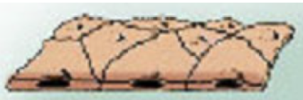 <p><span style="background-color: transparent;">a single layer of <u>thin</u> flattened cells</span></p><ul><li><p><span style="background-color: transparent;">Allows for good drug absorption</span></p></li><li><p><span style="background-color: transparent;">Found in: Lung’s alveoli and kidney’s filtration tubule</span></p></li><li><p><span style="background-color: transparent;">Endothelium (inner surface of blood vessels) is also similarly structured, which is what makes injections effective</span></p></li></ul><p></p>