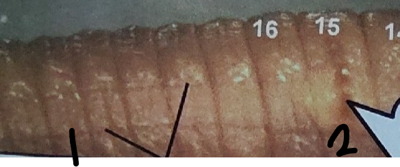 <p>What is point 2 on this earthworm</p>