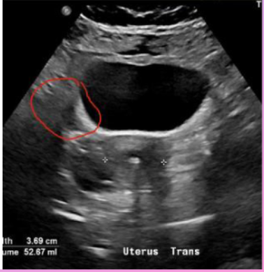 <p>What muscle is this showing?</p>
