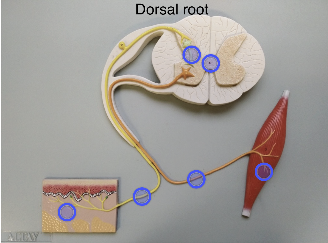 <p>Carries sensory signals INTO the spinal cord</p>