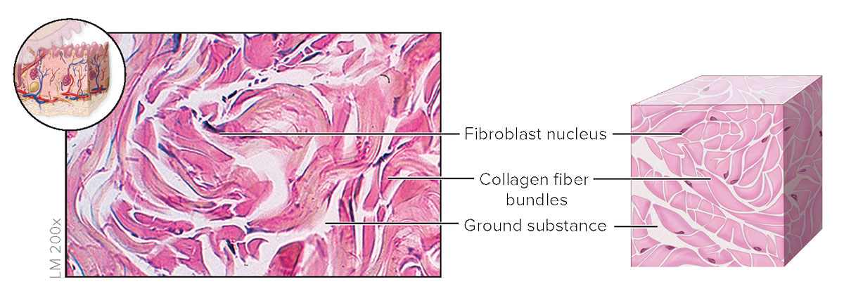 <p><strong>Dense Irregular Connective Tissue</strong></p>