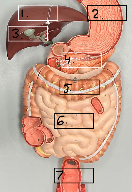 <p>Label this image.</p>