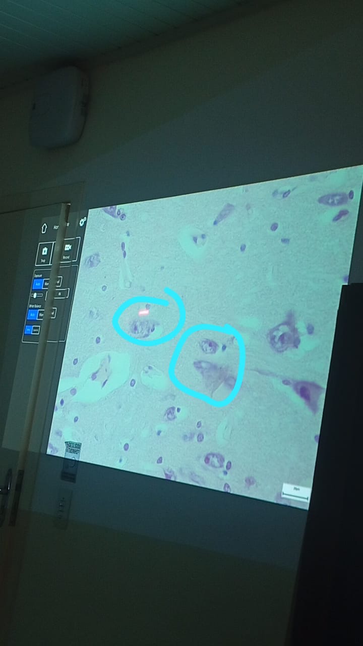 term image