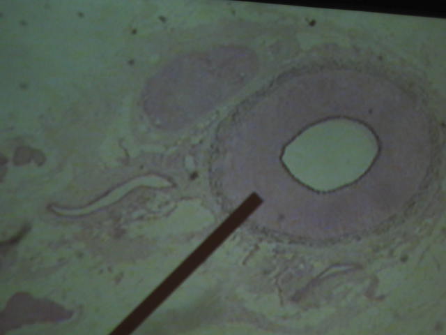 <p>Identify The Vessel</p><p>Lab Image 3-18</p>