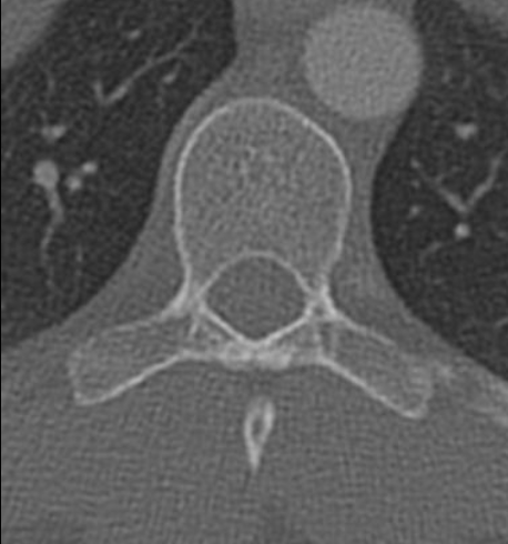 <p><span>胸椎</span></p>