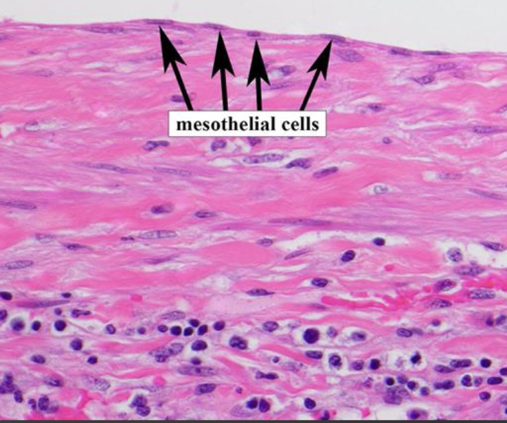 <p>What kind of epithelium is this </p>