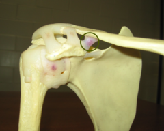 <p>identify the structure</p>