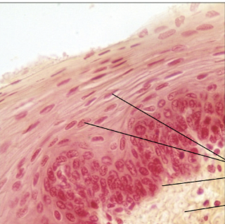 <p><span><strong>Stratified squamous</strong></span></p>