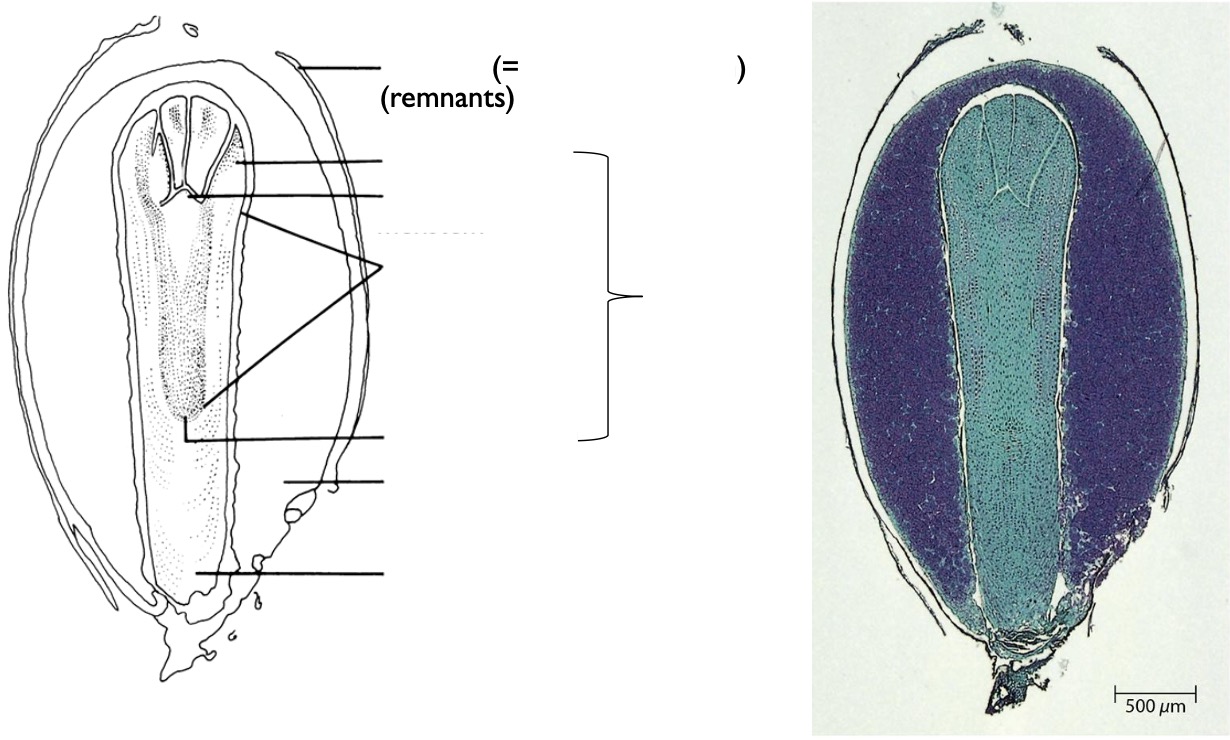 <p>Identify the structures of a pine seed.</p>