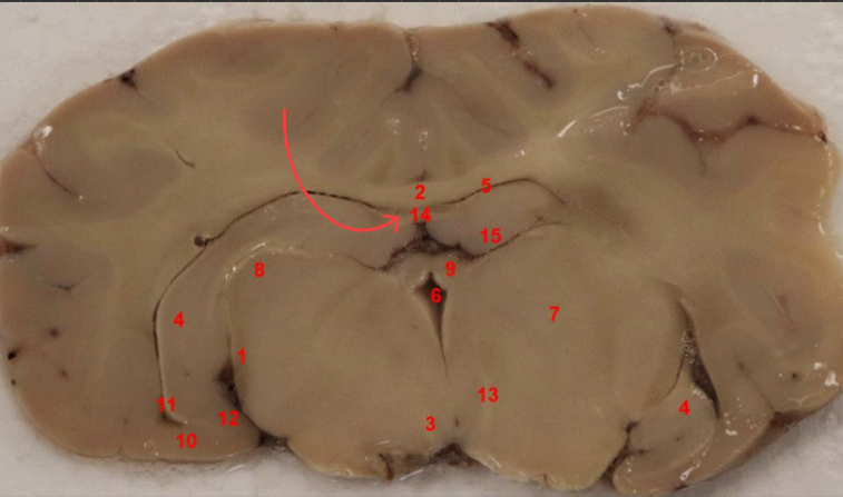 <p>what tract is this </p>