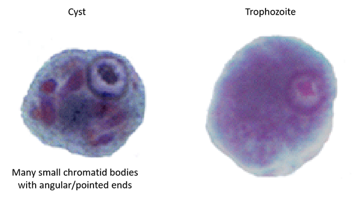 <p>Cysts: many small chromatid bodies with angular pointed ends<br>Trophozoite: empty looking</p>