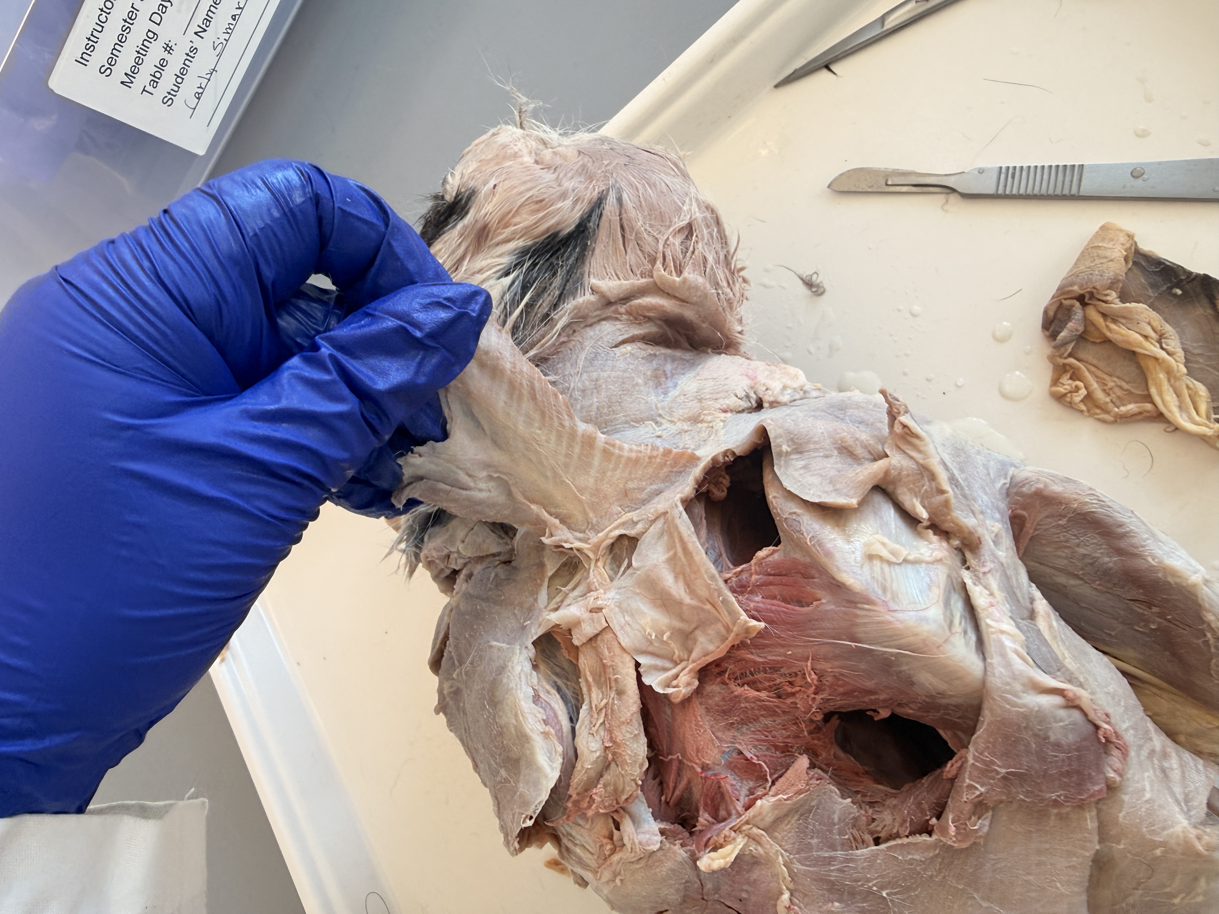 <p>Name this muscle </p>