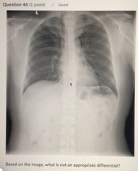 <p>Based on the image what is NOT an appropriate differential:</p><p>a. Lymphoma </p><p>b. Thoracic aneurysm</p><p>c. Metastasis </p><p>d. Goiter</p>
