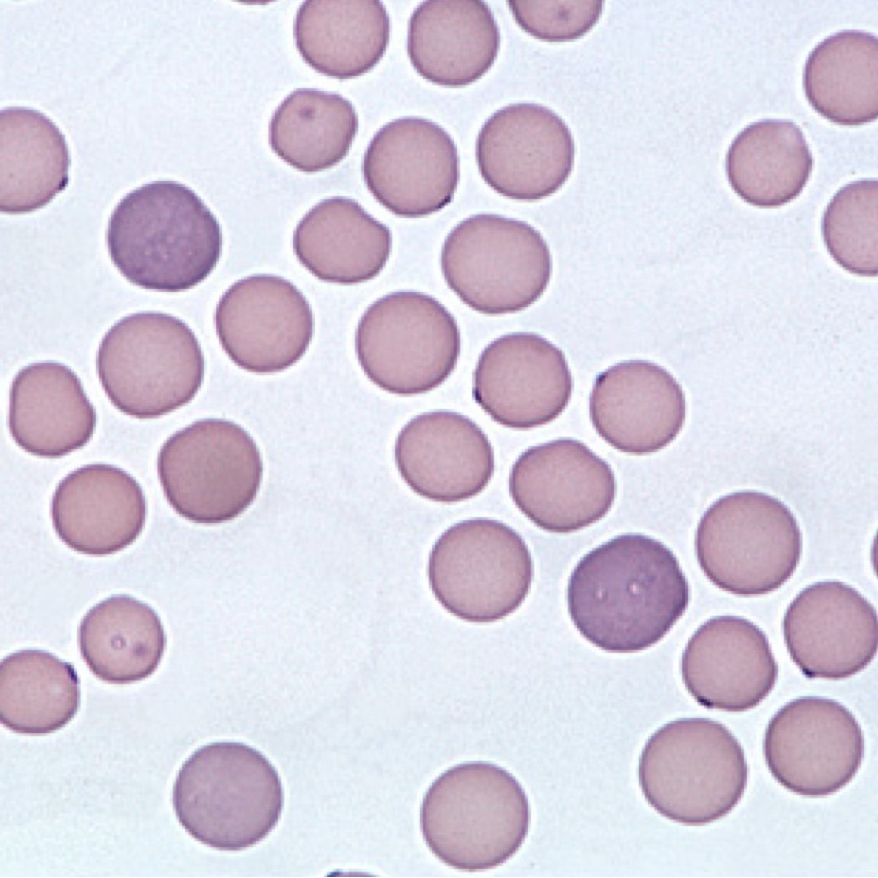 <p>What is the name of the larger bluish cells? </p>