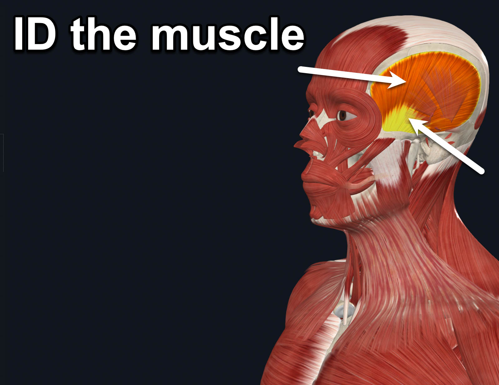 term image