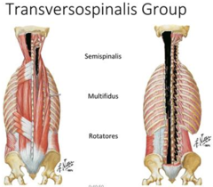 <p>Semispinalis (superficial)</p><p>Multifidus</p><p>Rotatores (deep)</p><p>unilateral: opposite side lateral rotation/ same side lateral flexion</p><p>bilateral: extension or hyperextension of spine</p>