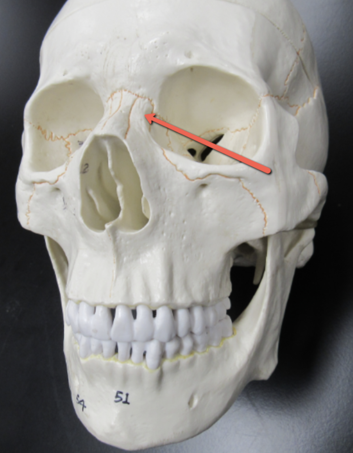 <p><span><strong>Identify the bone marking indicated by the pointer.</strong></span></p>