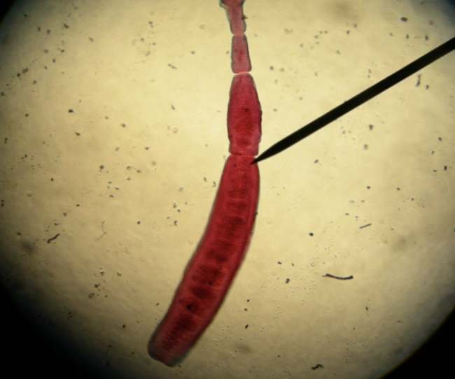 <p>What cestode/tapeworm/parasitic worm is this?</p>
