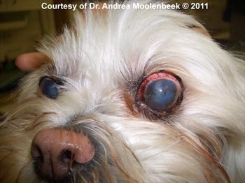 <p>Glaucoma</p>