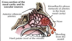 <p>pinch nose, wait 5-10 minutes minimum:</p><p>- if bleeding persists, consider nasal packing</p><p>- may also use cautery</p>