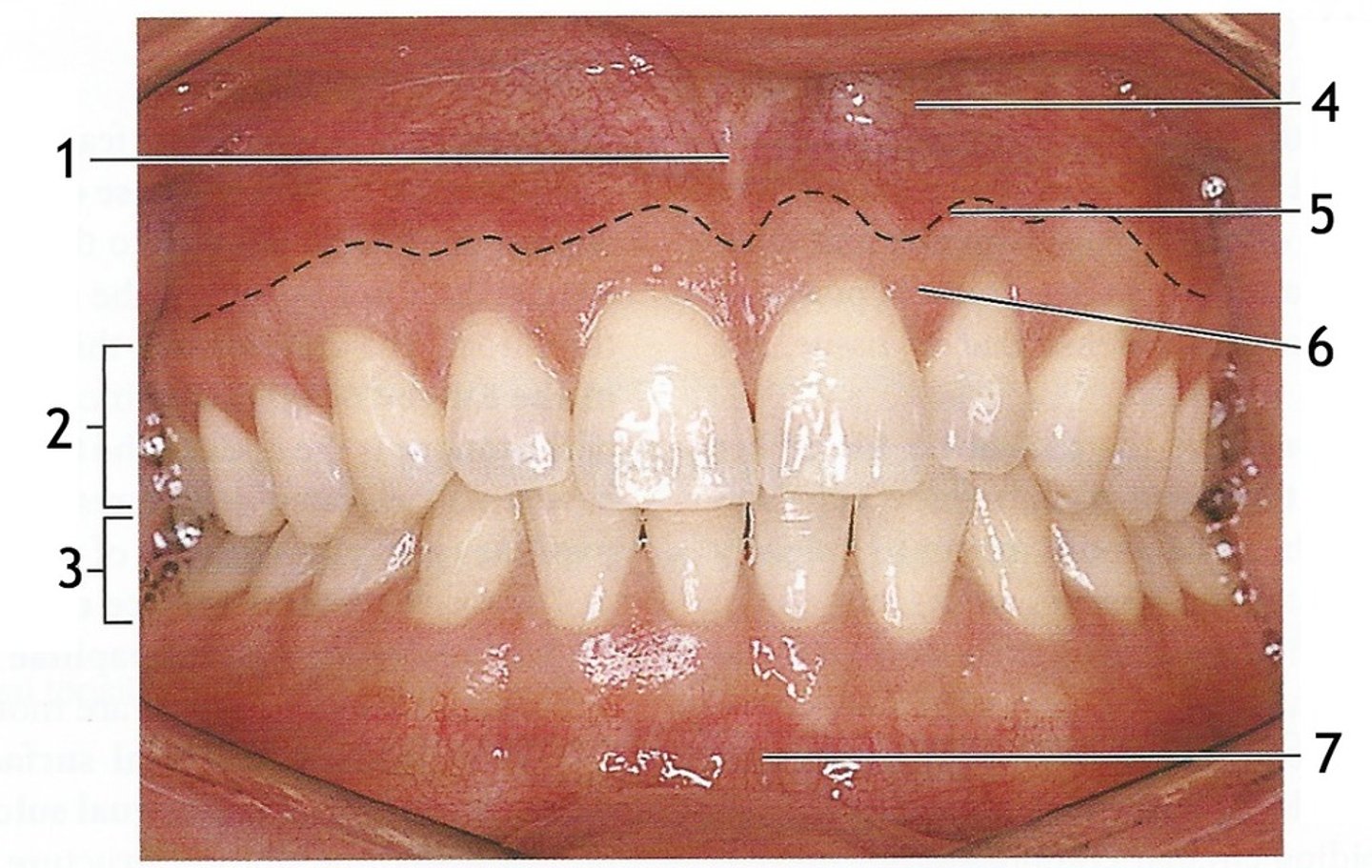 <p>liên tiếp (xảy ra liên tục hết cái này đến cái khác theo một trình tự)</p>