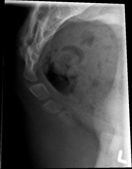 <p>critique this coccyx lateral</p>