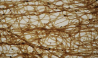 <p>Is this micrograph image an example of a sea sponge’s <strong>spicules</strong> or <strong>spongin?</strong></p>