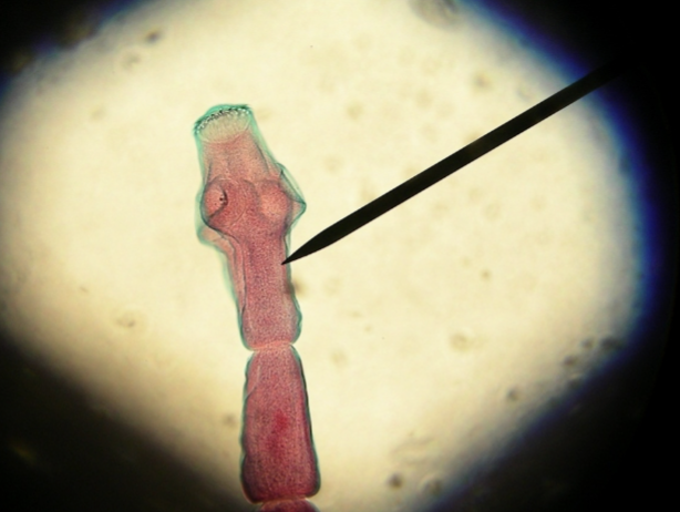 <p>What cestode/tapeworm/parasitic worm is this?</p>