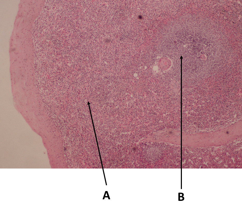 <p><span>Identify the organ in this image.</span></p>