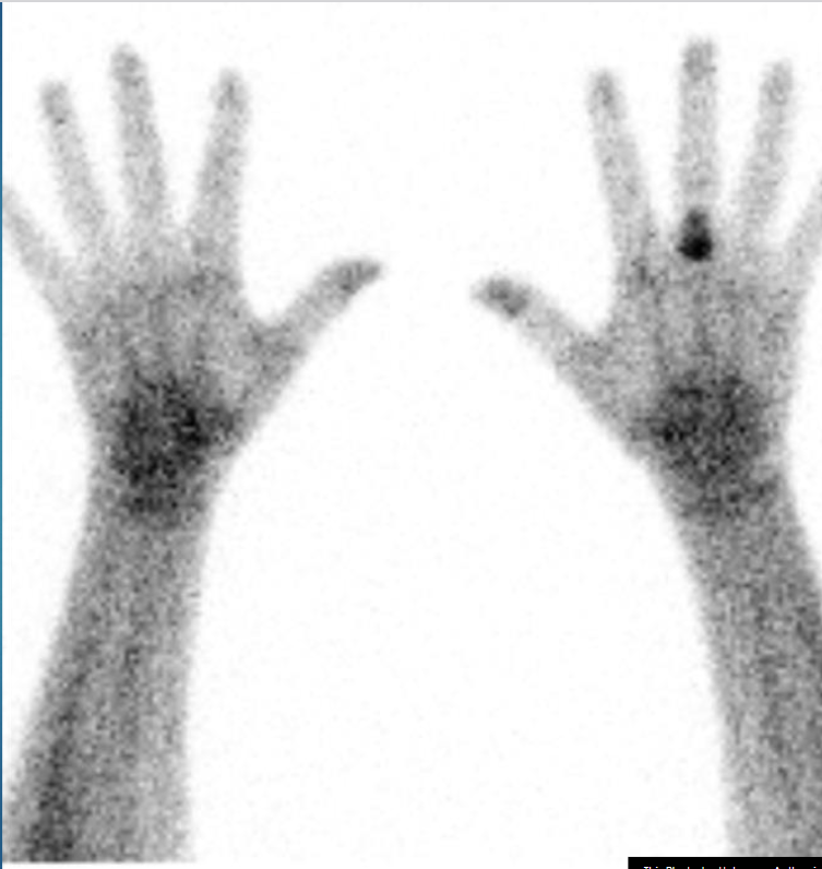 <p>FUNCTIONAL imaging</p><ul><li><p>shows how organs and tissues work (physiology) </p></li><li><p>not for structural images</p></li></ul><p></p>