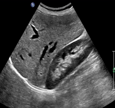 <p>Identify this image. </p>