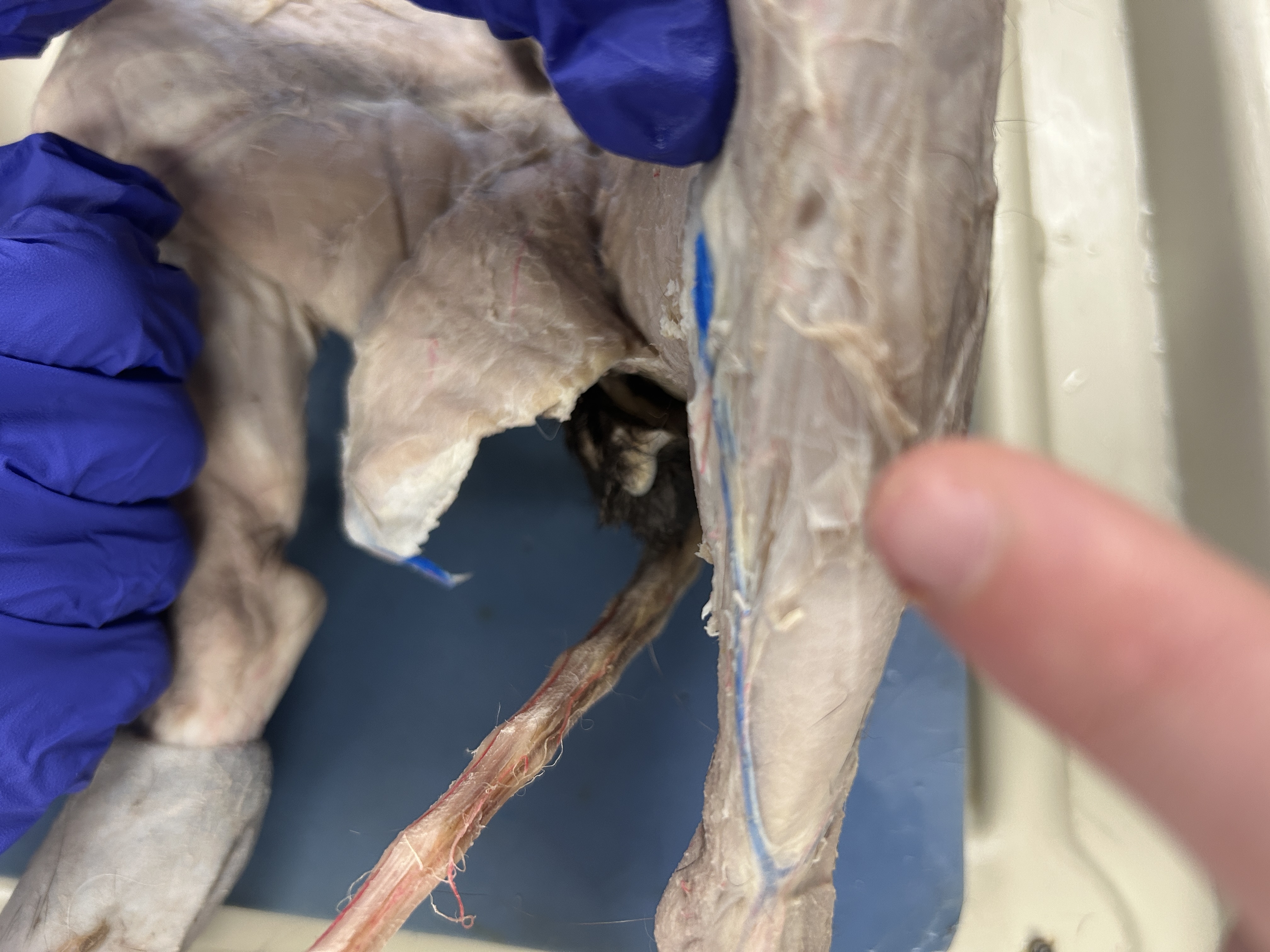 <p>Tibialis Anterior (front of leg)</p>