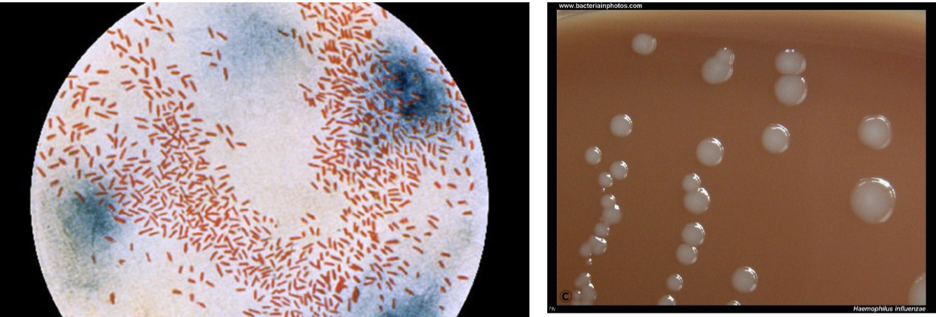 <p>what bacterial genus gram stain is described below:</p><ul><li><p>pleomorphic GNR</p></li><li><p>coccobacillary (usually) → filamentous </p></li><li><p>can stain <strong>faintly</strong> and be missed</p></li></ul><p></p>