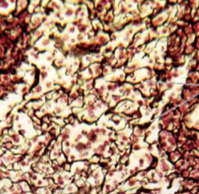 <p>Loose or dense CT Proper?</p><ul><li><p>IF DENSE: Regular or Irregular </p></li></ul><p></p>