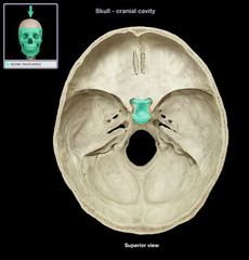 <p>a part of the sphenoid bone</p>