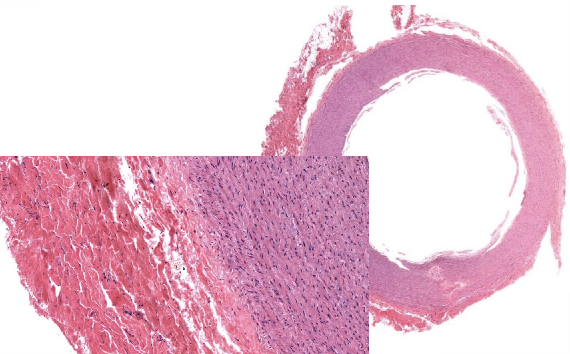 <p>Identify the Vessel and the Layer pictured</p>