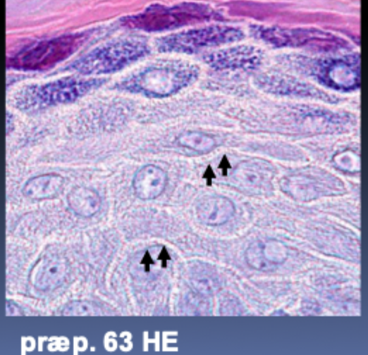<p>Keratin-intermediære filamenter</p>