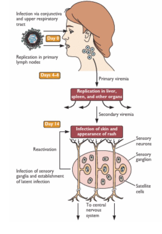 <p>- infection is initiated on conjunctiva or mucosa of URT and spreads to regional lymph nodes</p><p>- Infected T cells enter bloodstream, cause a primary viremia (virus replicates at the first site)</p><p>- Also invade liver, spleen and other organs, initiate secondary viremia (virus replicates in other organs)</p><p>- Infected skin-homing T cells invade skin and initiate third round of infection ~ 2 weeks after initial infection - characteristic chicken pox rash appears</p><p>- Virions in skin infect sensory nerve terminals and spread to dorsal root ganglia of the peripheral nervous system, where a latent infection is established</p><p>- Decline in immunity with aging and other factors induces reactivation, and shingles</p>