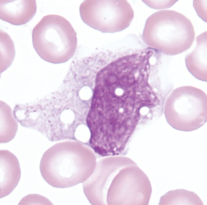 <p>What WBC is this?</p>