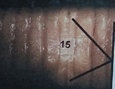 <p>What is this on the earthworm </p>