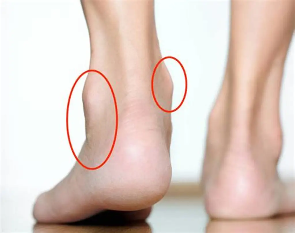 <p>The joint connecting the foot to the leg.</p>