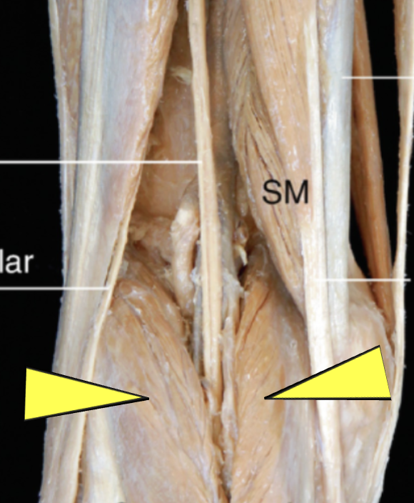 <p>ID muscle</p>