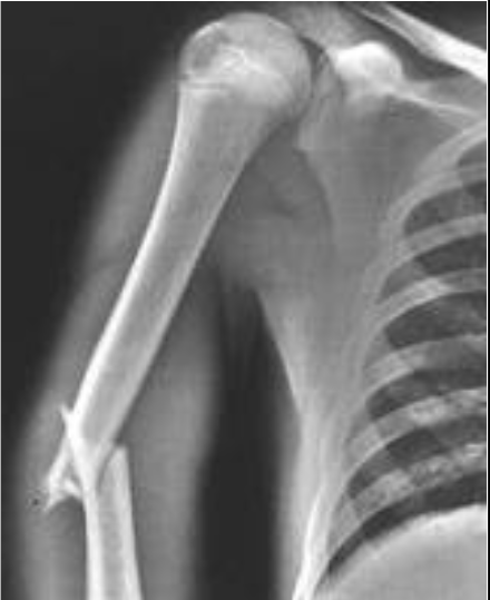 <p>What X-Ray machine was used for this image?</p>