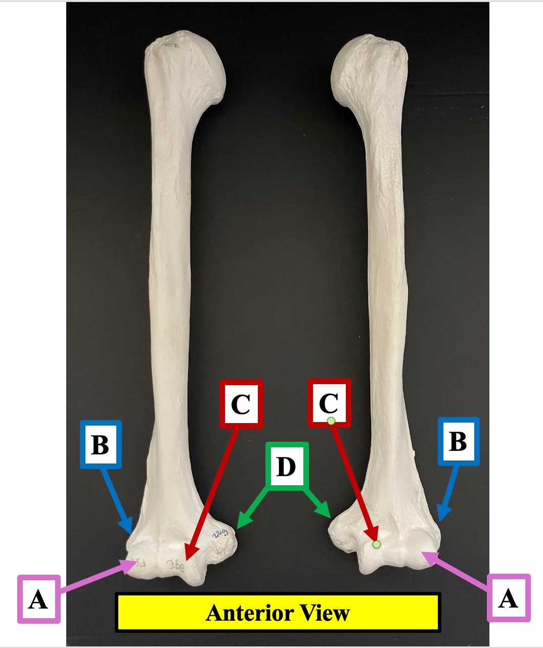 <p>Identify the name of the bony landmark of the humerus that label <strong>C </strong>is pointing to.</p>